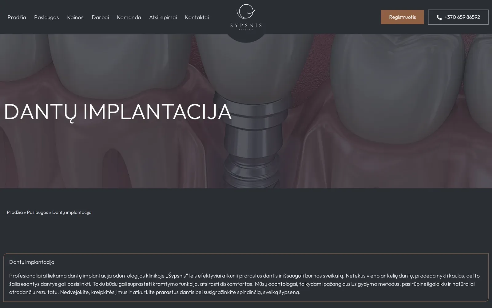 sypsnis.lt – paslaugos puslapis – dantų implantacija